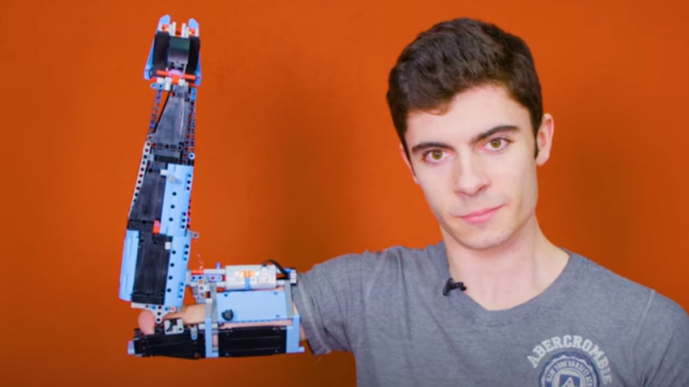 Đằng sau câu chuyện về chàng trai có cánh tay LEGO